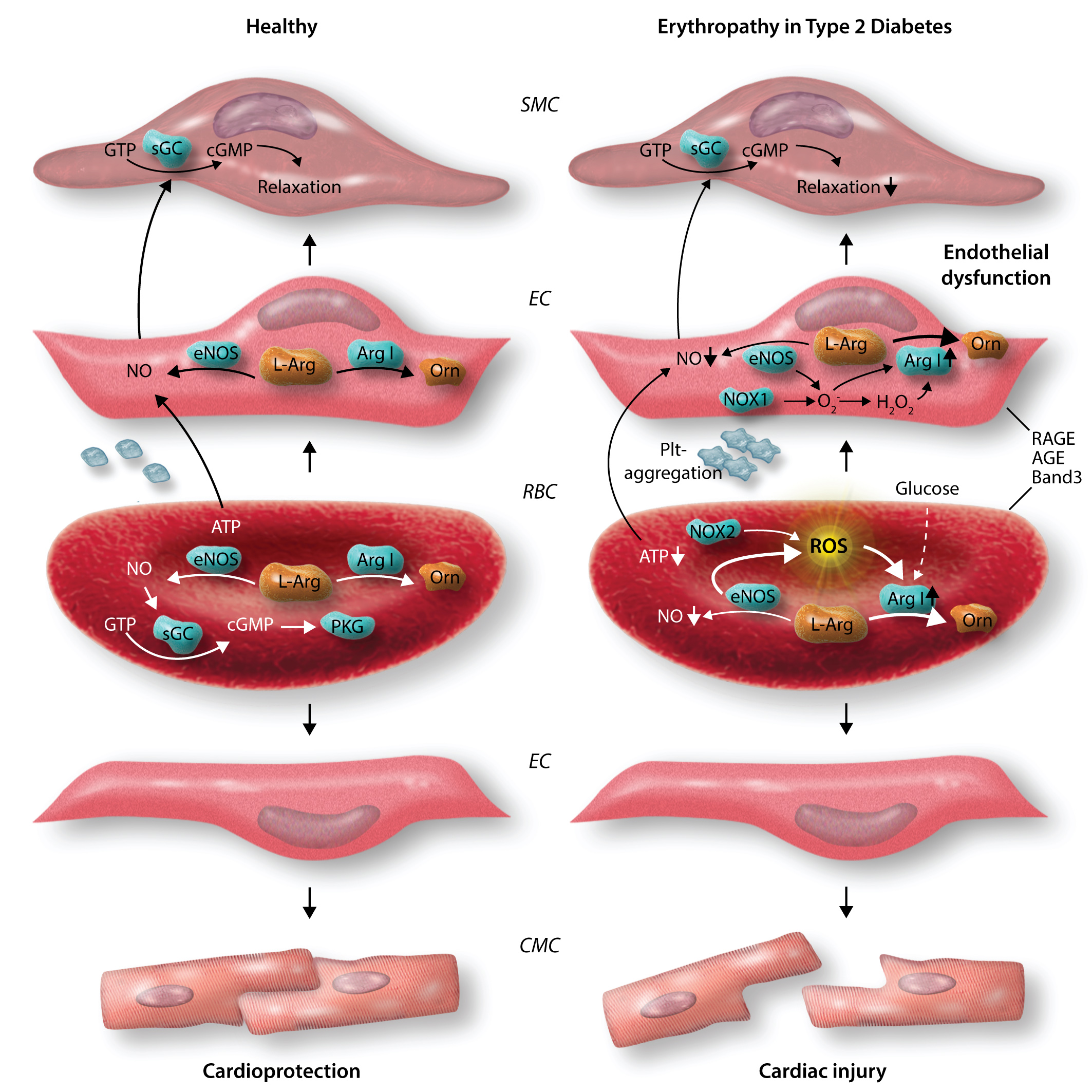 Red #blood cell dysfunction: a new player in #cardiovascular disease ...